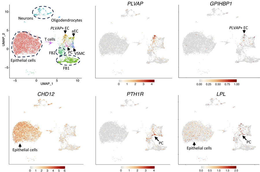Transcriptomic analyses of disease-free human choroid plexus revealed th...