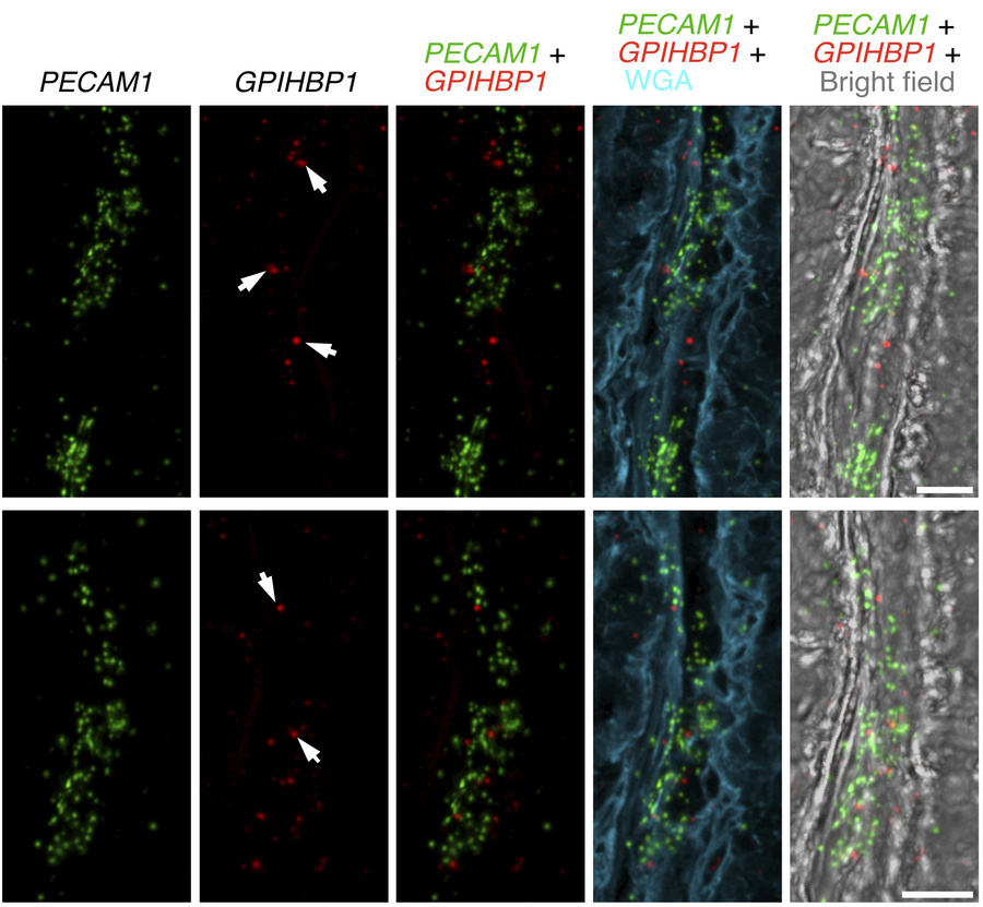 ISH studies — with RNAscope probes — of PECAM1 expression and GPIHBP1 ex...