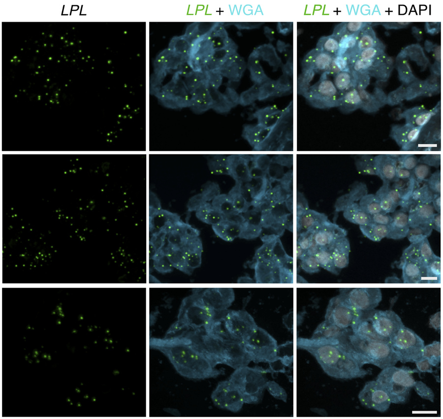 ISH studies — with RNAscope probes — of LPL transcripts in epithelial ce...