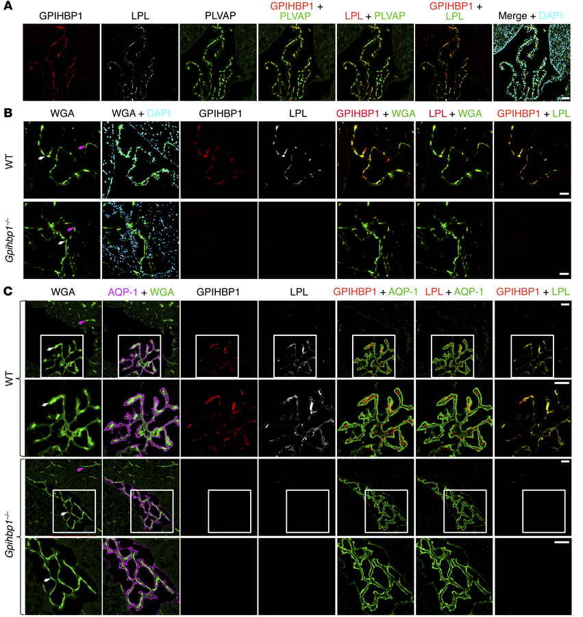 GPIHBP1 and LPL are on the luminal surface of ChP capillaries in WT mice...