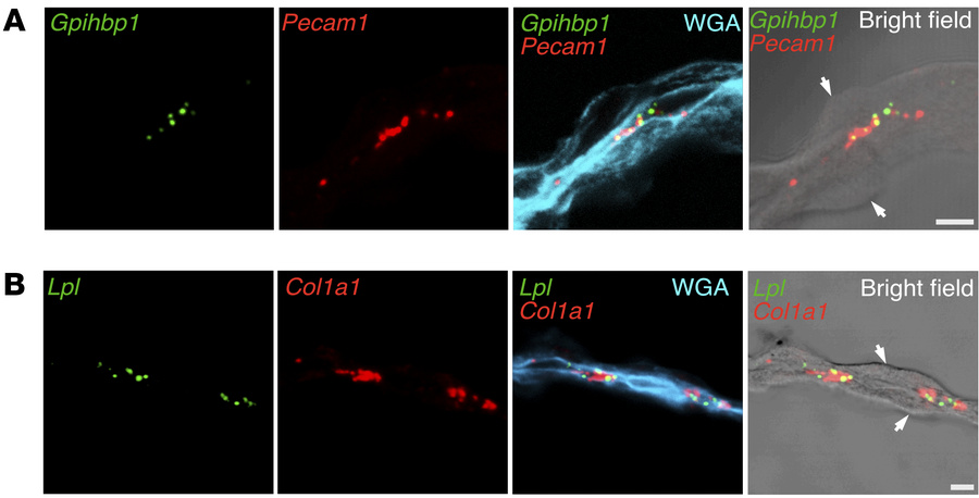 ISH studies, with RNAscope probes, of Lpl, Col1a1, Gpihbp1, and Pecam1 e...