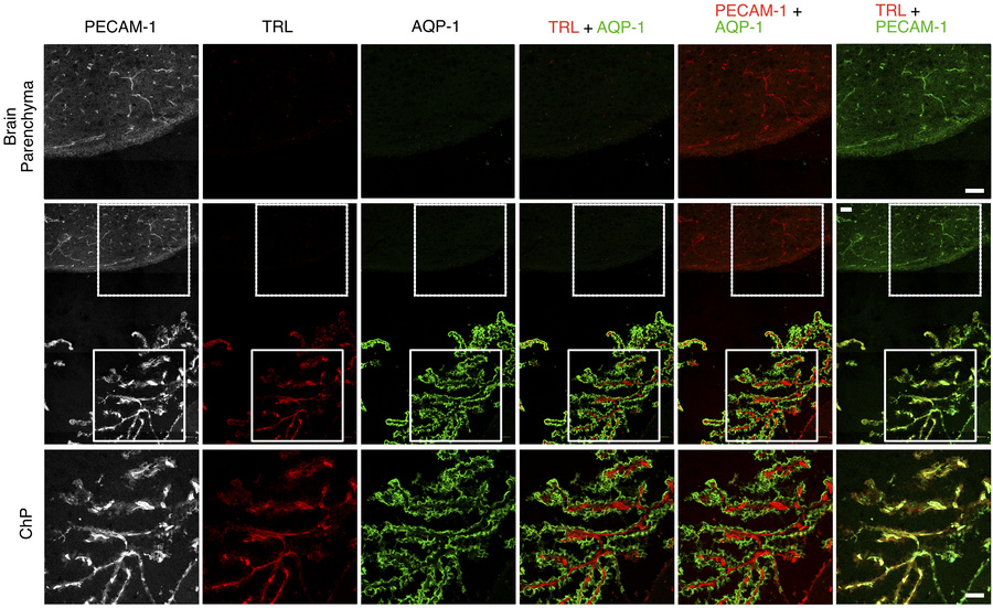 Confocal micrographs showing margination of TRLs along the luminal surfa...
