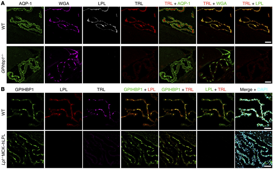 Confocal microscopy to assess TRL margination along ChP capillaries.
(A)...