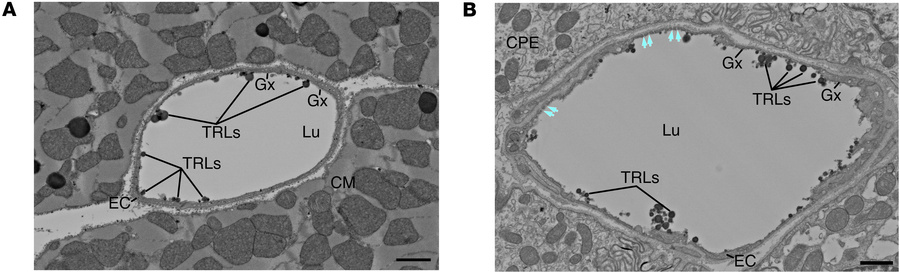 Scanning electron micrographs of thick sections from mouse heart (A) and...