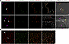 Confocal micrographs revealing GPIHBP1 in PECAM-1–positive capillary ECs of