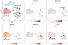 Transcriptomic analyses of disease-free human choroid plexus revealed that