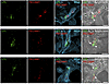ISH studies — with RNAscope probes — of LPL and PECAM1 expression in human