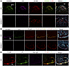 Confocal micrographs demonstrating GPIHBP1 and LPL on the luminal surface o
