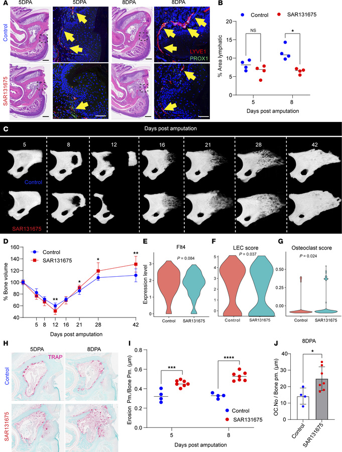 VEGFR3 inhibition enhances osteoclast-mediated bone resorption and accel...