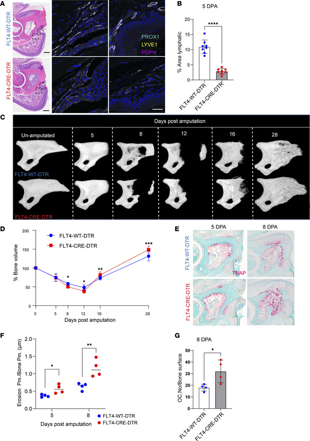 Impact of LEC ablation on osteoclast activity and digit tip regeneration...