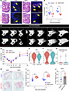 VEGFR3 inhibition enhances osteoclast-mediated bone resorption and accelera