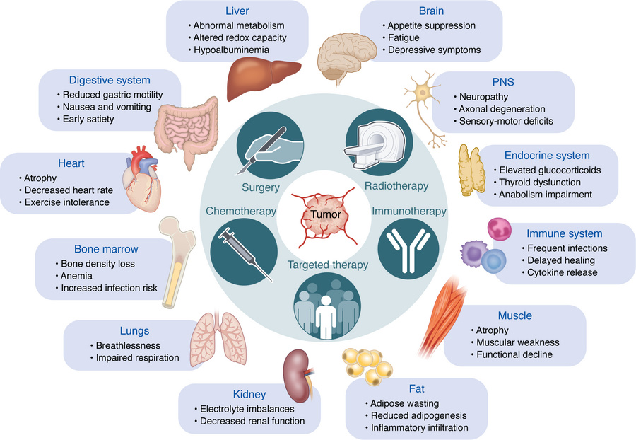 Conceptual framework: systemic interplay between cancer, therapy, and or...