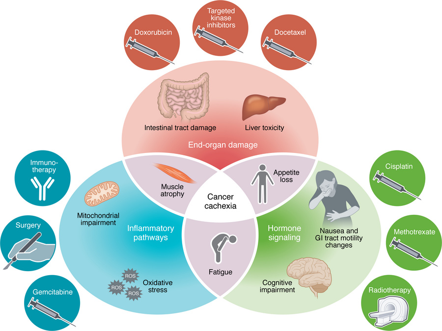 Detrimental contribution of treatment toxicity to cachexia.
The interpla...
