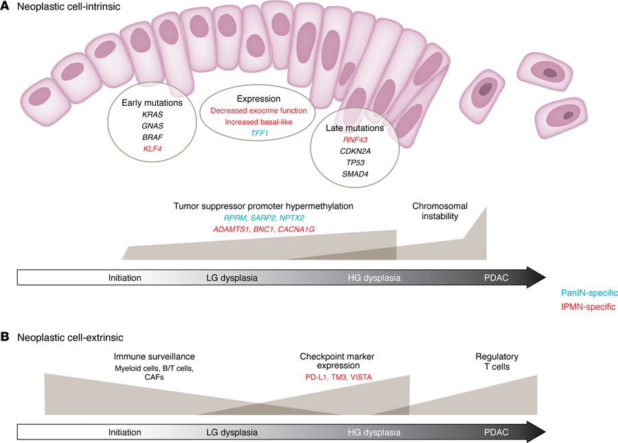 Drivers of pancreatic precancer progression.
Schematic of known neoplast...