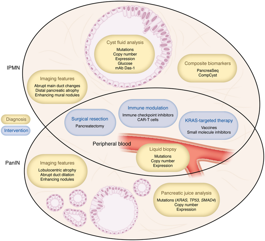 Current and potential opportunities for pancreatic precancer interceptio...