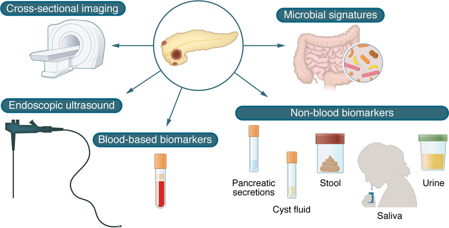 Current and investigational methods of screening for PC.