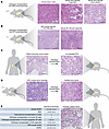 In vivo models of pancreas cancer.