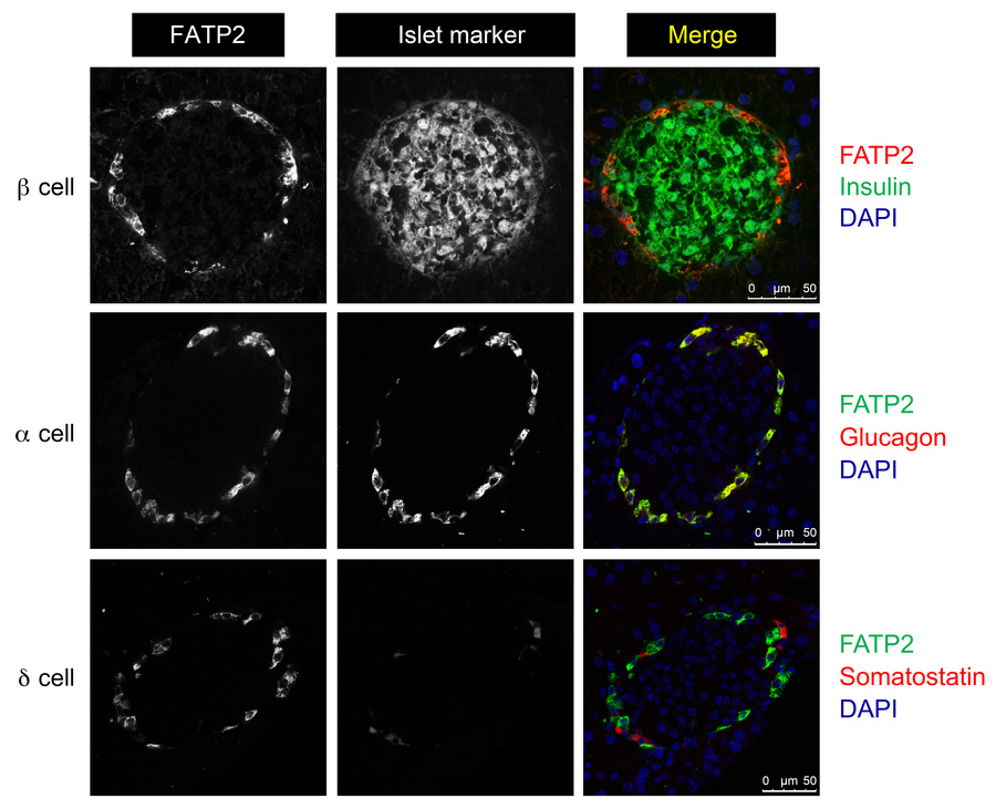 JCI - Fatty acid transport protein 2 inhibition enhances glucose ...