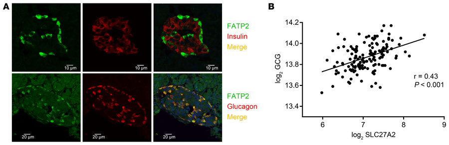 FATP2 expression localizes to pancreatic α cells in human islets.
(A) Pa...