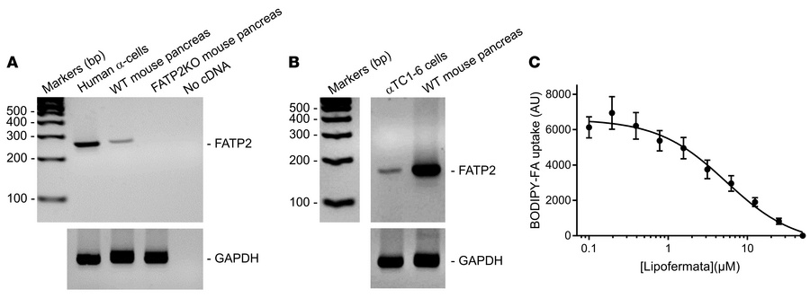 FATP2 expression and function in α cells.
(A and B) FATP2 and loading co...