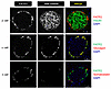 FATP2 expression localizes to pancreatic α cells in mouse islets.