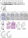HHEX expression is increased in inflamed colon tissues of patients with UC.