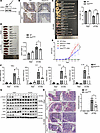 Knockout of HHEX alleviates DSS-induced acute colitis.