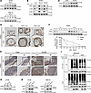 TNF-α stabilizes the HHEX protein via IKKα kinase in IECs.