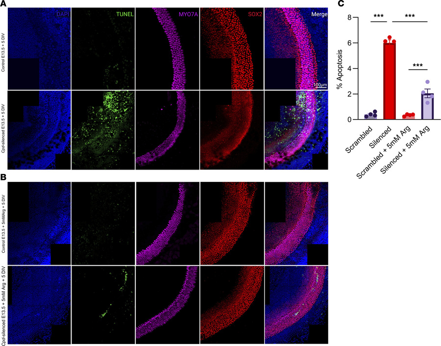 Silencing Cpd in the mouse cochlea enhances apoptosis rescued by arginin...
