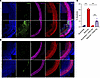 Silencing Cpd in the mouse cochlea enhances apoptosis rescued by arginine s