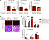 Reduced fibrosis-memory in the absence of CD4+ T cells.
