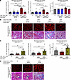 Fibrosis-memory can be adoptively transferred by splenic and renal CD4+ T c