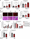 Fibrosis-memory can be transferred by memory but not naive CD4+ T cells.
