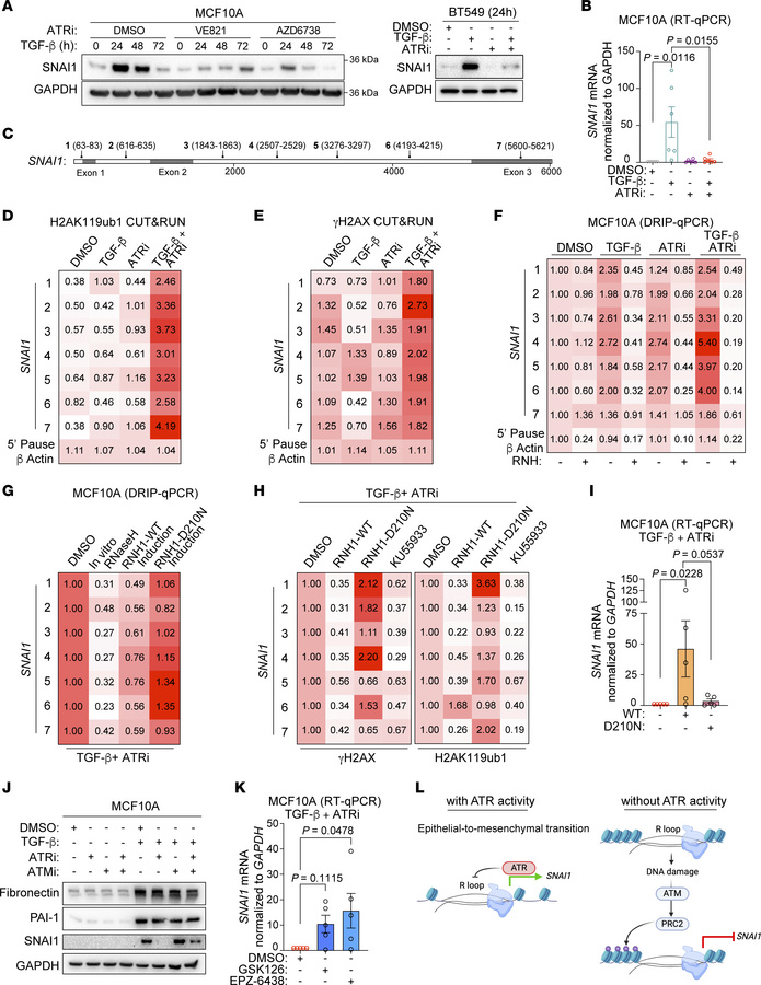 ATR enables SNAI1 expression during EMT.
(A) Western blot of SNAI1 in in...