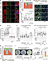 ATR suppresses DNA damage during EMT by limiting R-loops and TRCs.