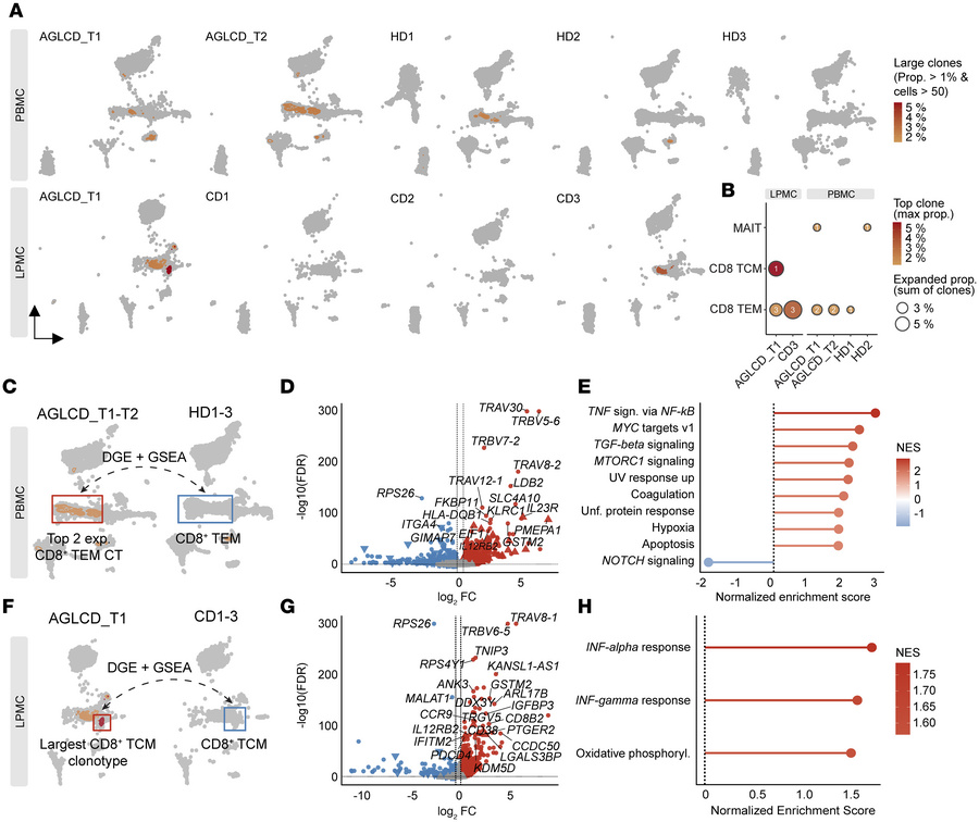 Characterization of clonally expanded T cells in the patient with AGLCD....