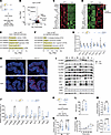Lipodystrophic mice display normal mucus production and have increased expr