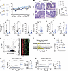 Lipodystrophic mice are protected from DSS-induced colitis.