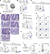 Allogeneic fat transplantation partially restores basal leptin levels, reve