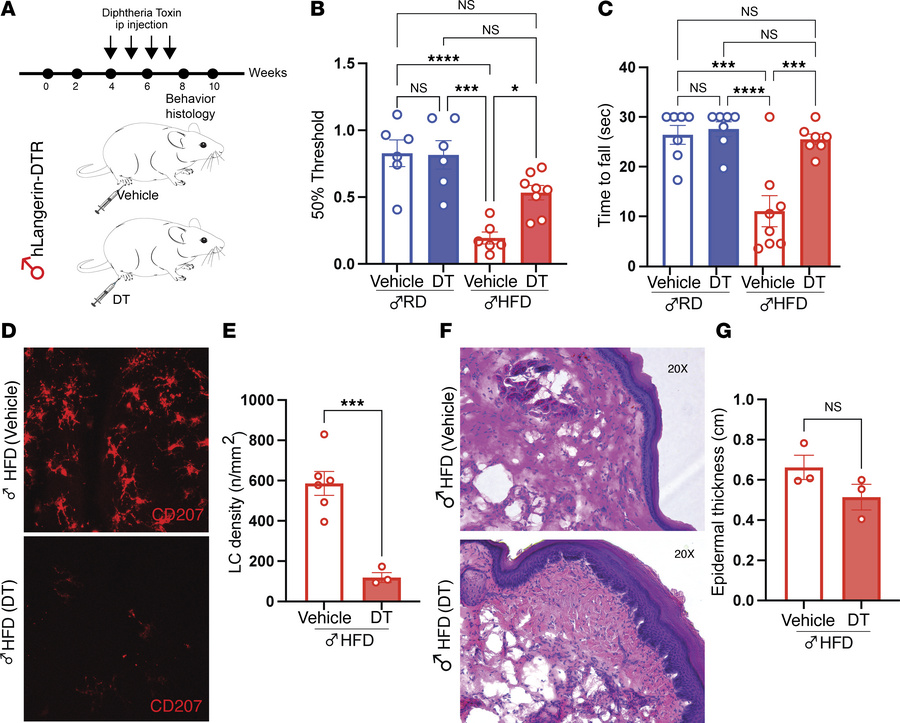LCs mediate mechanical allodynia and spontaneous pain in HFD.
(A) Timeli...