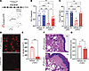 LCs mediate mechanical allodynia and spontaneous pain in HFD.