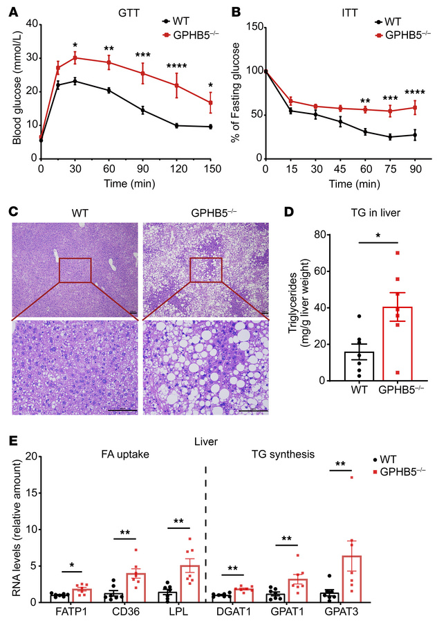 Lack of GPHB5 led to glucose intolerance, insulin resistance, and hepati...