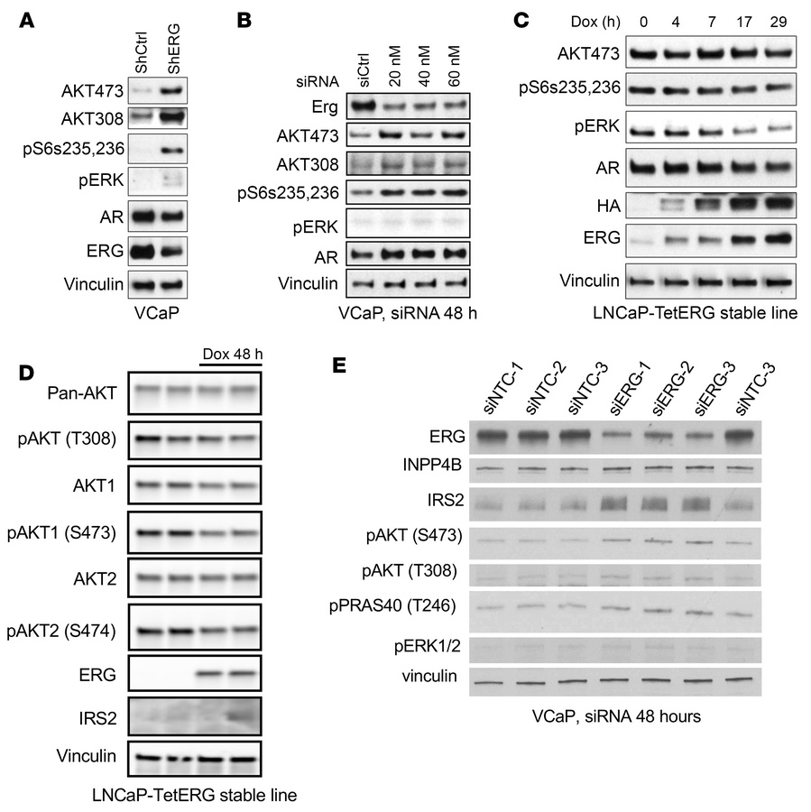 ERG suppresses AKT activity and IRS2 expression in PCa cells.
(A) VCaP c...