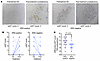 AKT phosphorylation prior to and after neoadjuvant AR-targeted therapy.