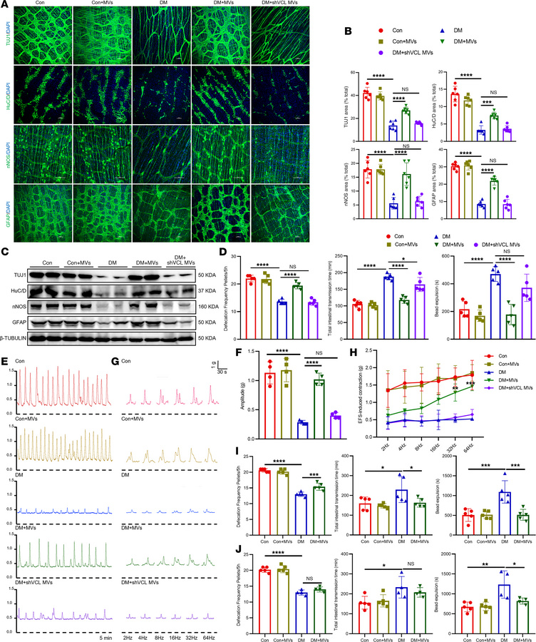 BMSC-MVs restore ENS structure and gastrointestinal motility in diabetic...