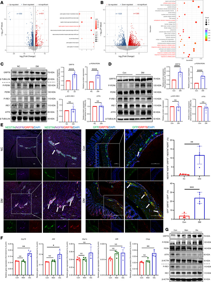 ER stress and UPR were activated in ENPCs under diabetic conditions.
(A ...
