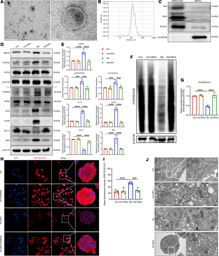 BMSC-MVs alleviate high glucose–induced ENPC damage.
(A–C) Characterizat...