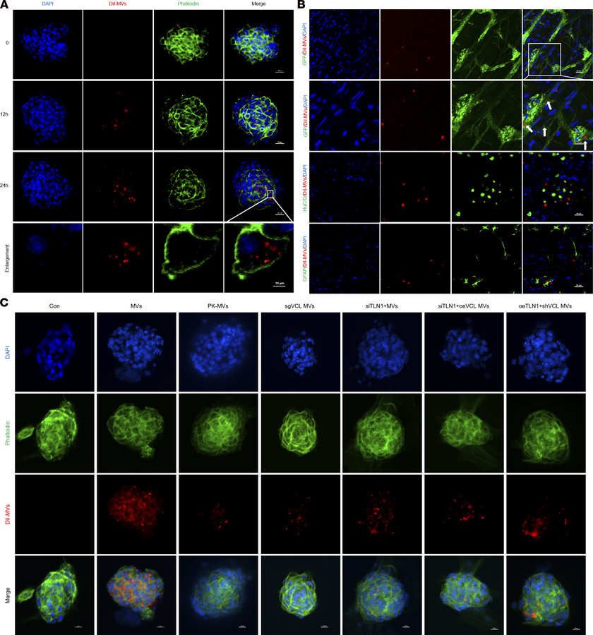 Uptake of BMSC-MVs by ENPCs and distribution within the ENS.
(A) Uptake ...