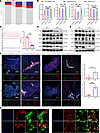 Diabetes-associated gastrointestinal motility dysfunction and ENS impairmen