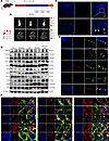 BMSC-MVs suppress ER stress and promote ENPC differentiation in ENPCs in di